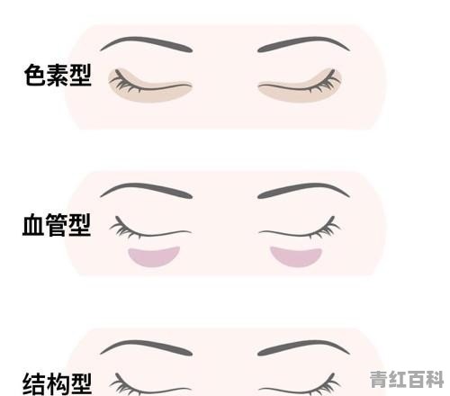 怎么去黑眼圈啊