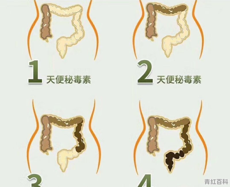 减肥期间便秘是否会影响效果